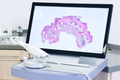 A dental 3D scanner and monitor displaying a digital model of teeth sit on a tray in a modern dental clinic, with a sink and cabinets in the background.